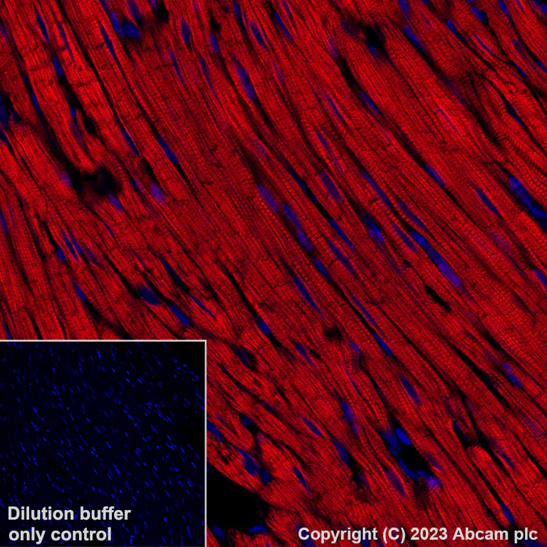 Immunohistochemistry (Formalin/PFA-fixed paraffin-embedded sections) - Alexa Fluor® 647 Anti-Cardiac Troponin I antibody [EPR20307] (AB309162)
