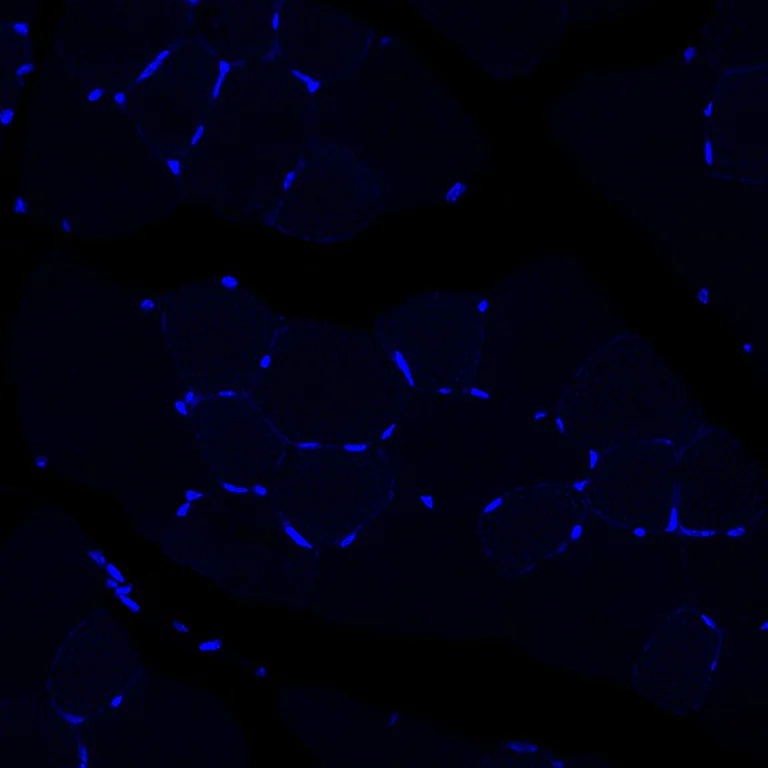 Immunohistochemistry (Formalin/PFA-fixed paraffin-embedded sections) - Alexa Fluor® 647 Anti-Cardiac Troponin I antibody [EPR20307] (AB309162)