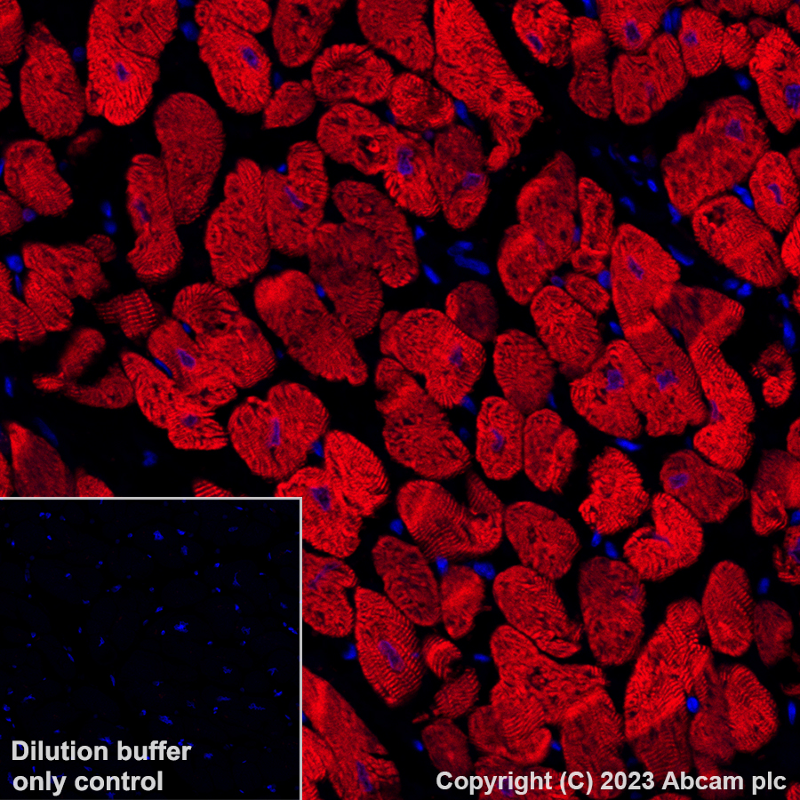 Immunohistochemistry (Formalin/PFA-fixed paraffin-embedded sections) - Alexa Fluor® 647 Anti-Cardiac Troponin T antibody [EPR20266] (AB314677), expandable thumbnail