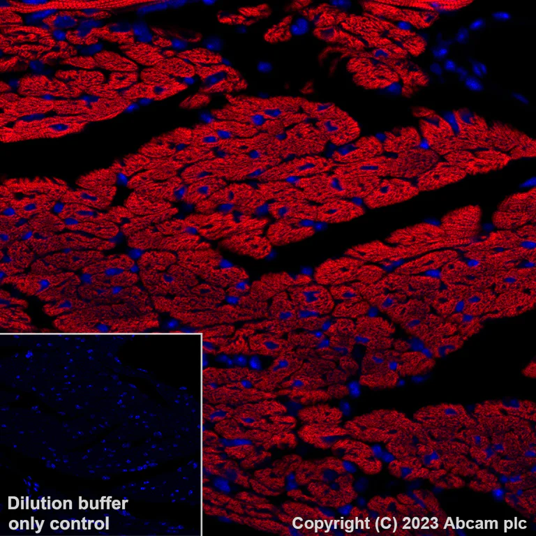 Immunohistochemistry (Formalin/PFA-fixed paraffin-embedded sections) - Alexa Fluor® 647 Anti-Cardiac Troponin T antibody [EPR20266] (AB314677)