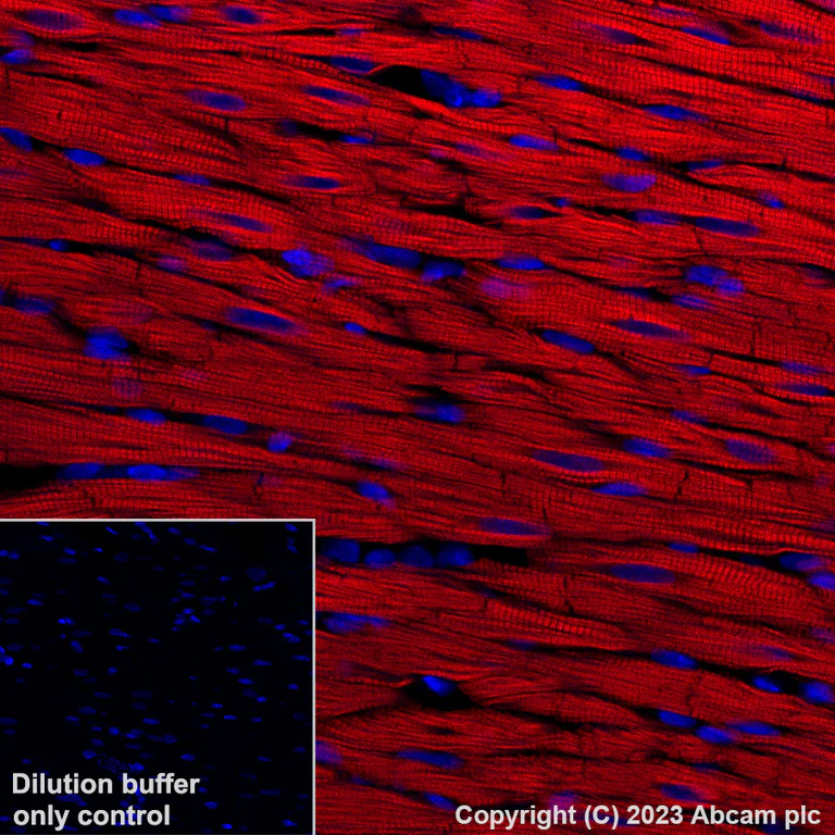 Immunohistochemistry (Formalin/PFA-fixed paraffin-embedded sections) - Alexa Fluor® 647 Anti-Cardiac Troponin T antibody [EPR20266] (AB314677)