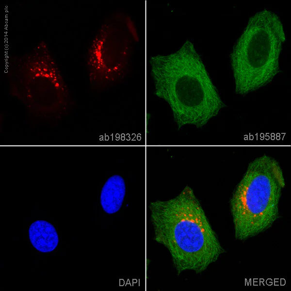 Immunocytochemistry/ Immunofluorescence - Alexa Fluor® 647 Anti-Cathepsin D antibody [EPR3057Y] (AB198326)