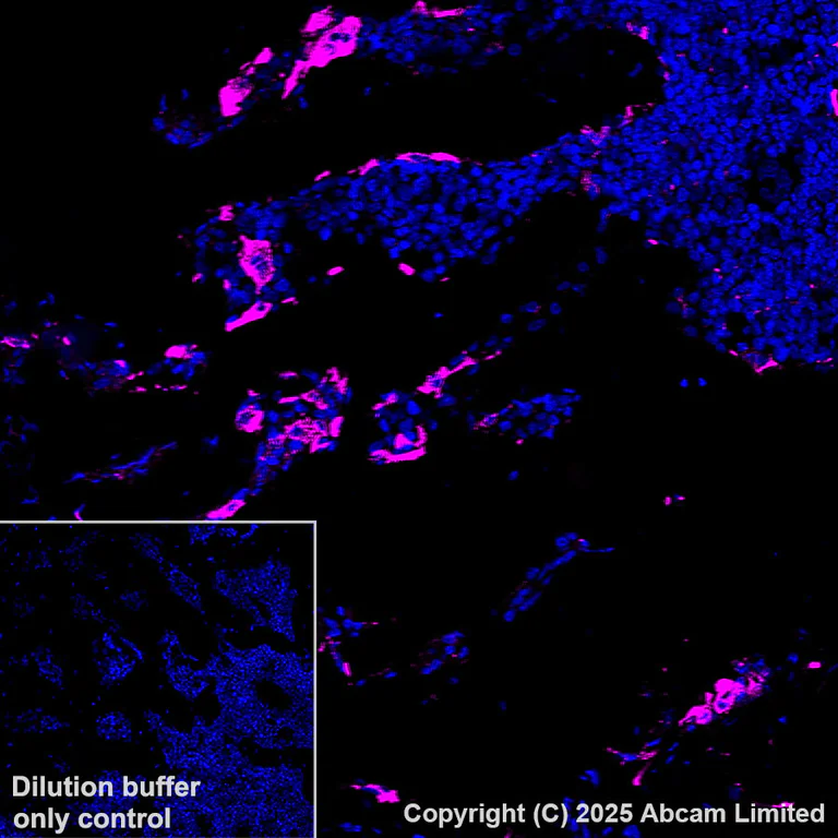 Immunohistochemistry (Formalin/PFA-fixed paraffin-embedded sections) - Alexa Fluor® 647 Anti-Cathepsin K antibody [EPR24829-101] (AB325221)