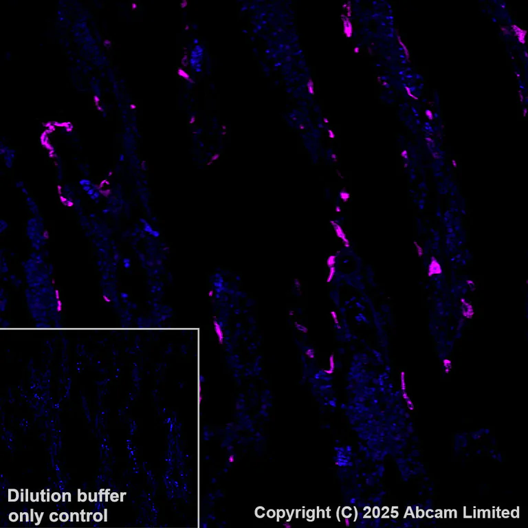 Immunohistochemistry (Formalin/PFA-fixed paraffin-embedded sections) - Alexa Fluor® 647 Anti-Cathepsin K antibody [EPR24829-101] (AB325221)
