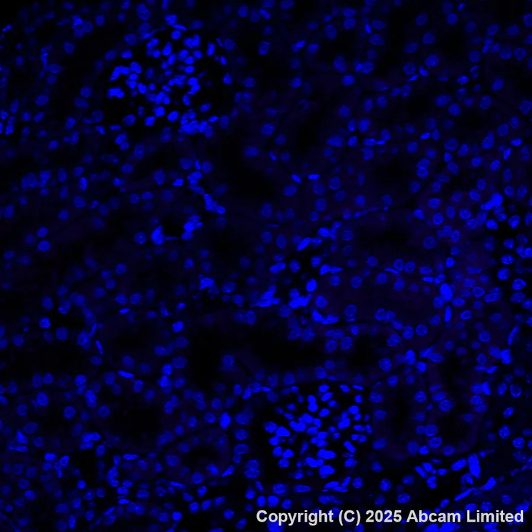 Immunohistochemistry (Formalin/PFA-fixed paraffin-embedded sections) - Alexa Fluor® 647 Anti-Cathepsin K antibody [EPR24829-101] (AB325221)