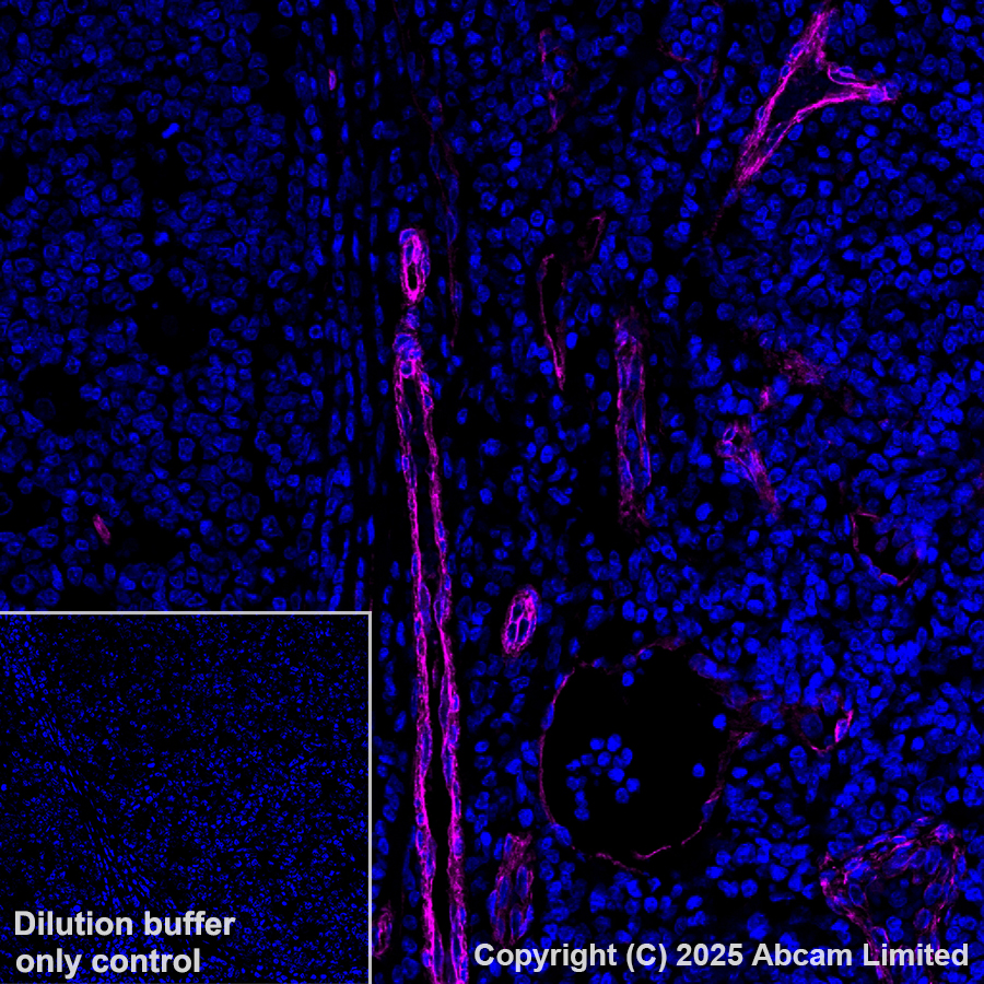 Immunohistochemistry (Formalin/PFA-fixed paraffin-embedded sections) - Alexa Fluor® 647 Anti-Caveolin-1 antibody [E249] - Caveolae Marker (AB193892)