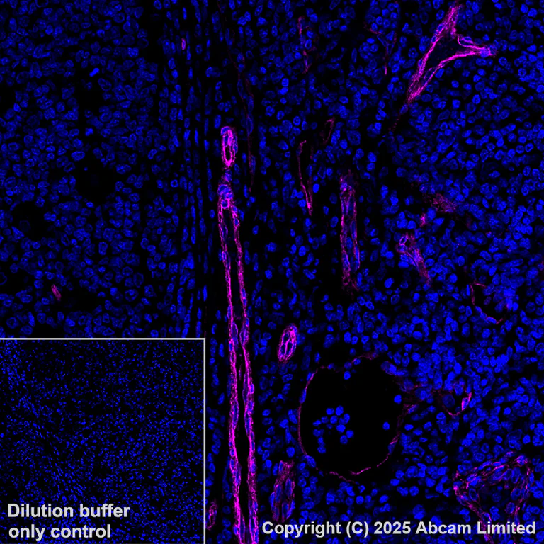 Immunohistochemistry (Formalin/PFA-fixed paraffin-embedded sections) - Alexa Fluor® 647 Anti-Caveolin-1 antibody [E249] - Caveolae Marker (AB193892)