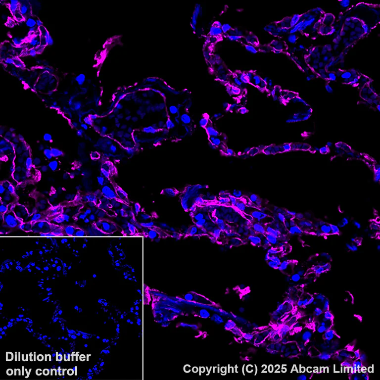 Immunohistochemistry (Formalin/PFA-fixed paraffin-embedded sections) - Alexa Fluor® 647 Anti-Caveolin-1 antibody [E249] - Caveolae Marker (AB193892)