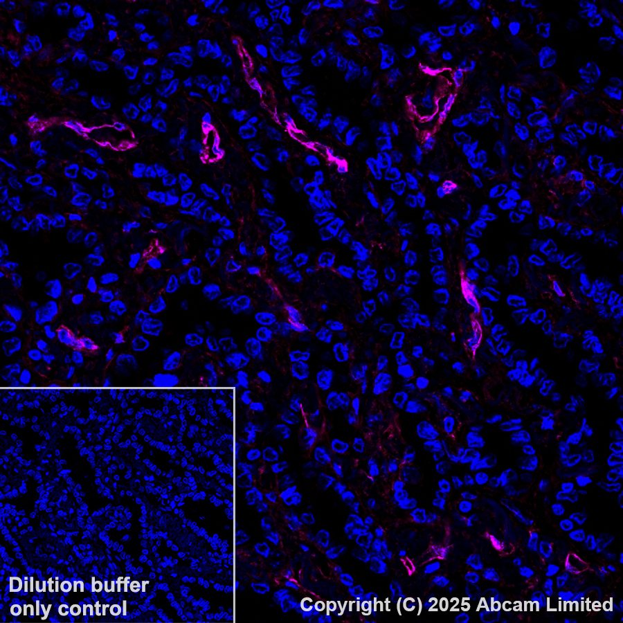 Immunohistochemistry (Formalin/PFA-fixed paraffin-embedded sections) - Alexa Fluor® 647 Anti-Caveolin-1 antibody [E249] - Caveolae Marker (AB193892)