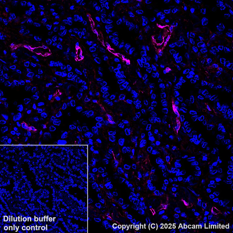 Immunohistochemistry (Formalin/PFA-fixed paraffin-embedded sections) - Alexa Fluor® 647 Anti-Caveolin-1 antibody [E249] - Caveolae Marker (AB193892)