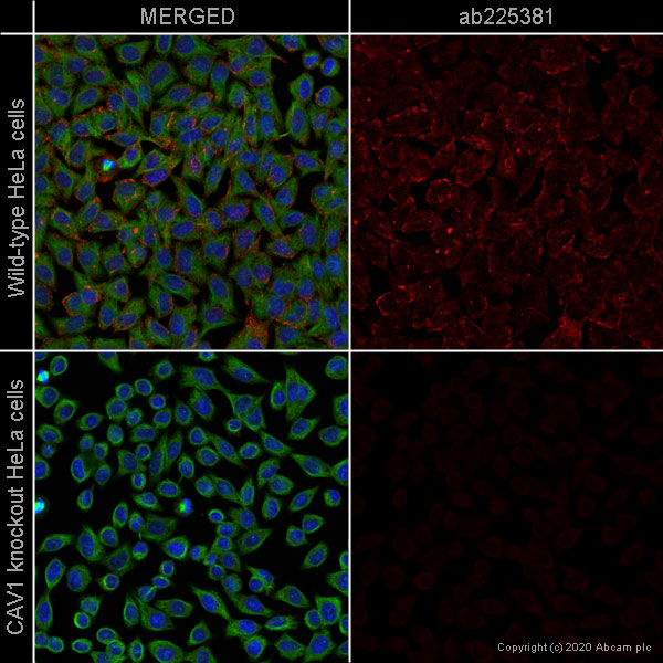 Immunocytochemistry - Alexa Fluor® 647 Anti-Caveolin-1 antibody [EPR15554] - N-terminal - Caveolae Marker (AB225381), expandable thumbnail