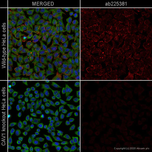 Immunocytochemistry - Alexa Fluor® 647 Anti-Caveolin-1 antibody [EPR15554] - N-terminal - Caveolae Marker (AB225381)