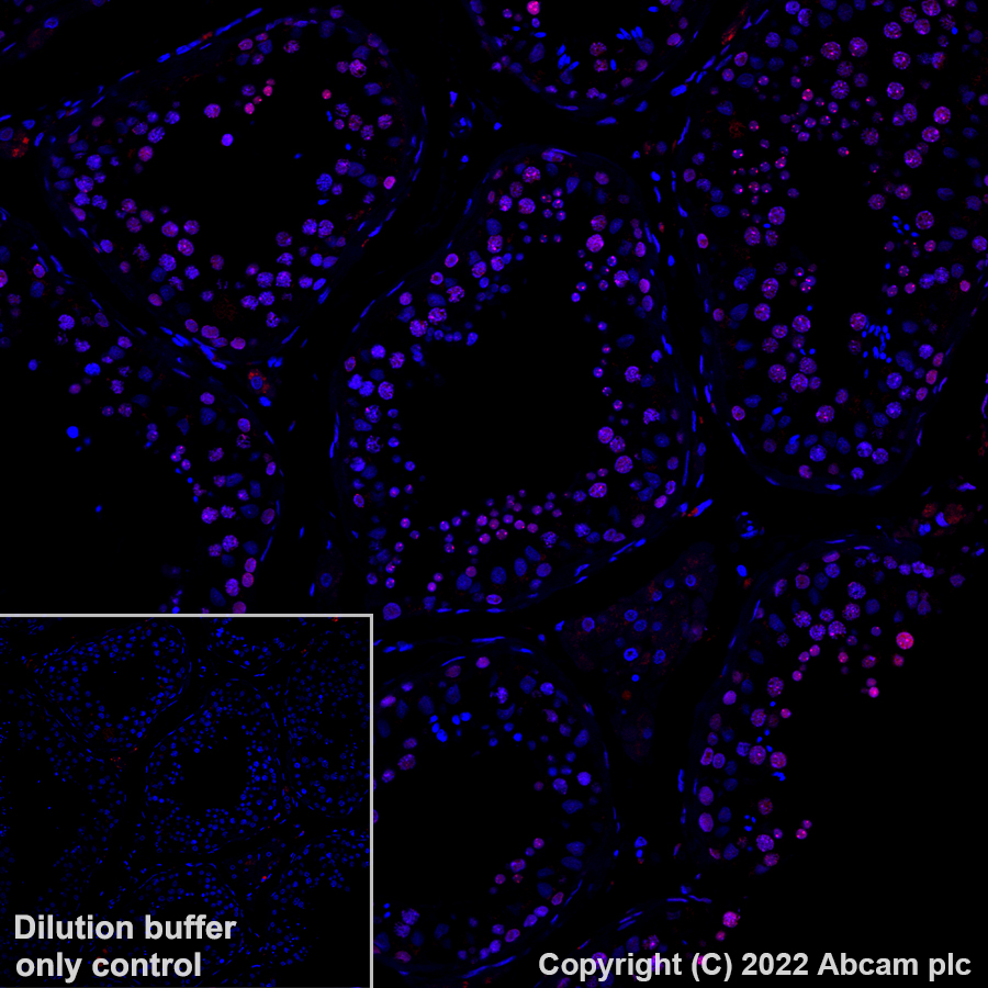 Immunohistochemistry (Formalin/PFA-fixed paraffin-embedded sections) - Alexa Fluor® 647 Anti-CBX1 / HP1 beta antibody [EPR24242-78] (AB307381), expandable thumbnail