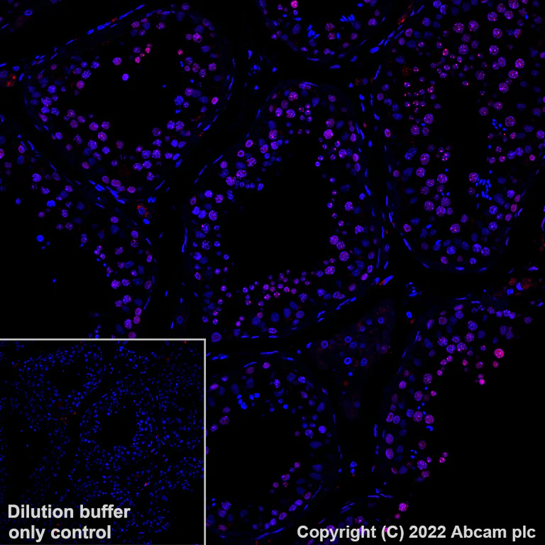 Immunohistochemistry (Formalin/PFA-fixed paraffin-embedded sections) - Alexa Fluor® 647 Anti-CBX1 / HP1 beta antibody [EPR24242-78] (AB307381)