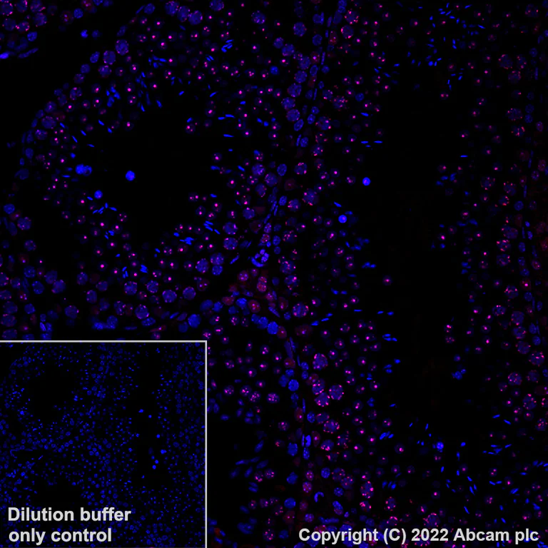 Immunohistochemistry (Formalin/PFA-fixed paraffin-embedded sections) - Alexa Fluor® 647 Anti-CBX1 / HP1 beta antibody [EPR24242-78] (AB307381)