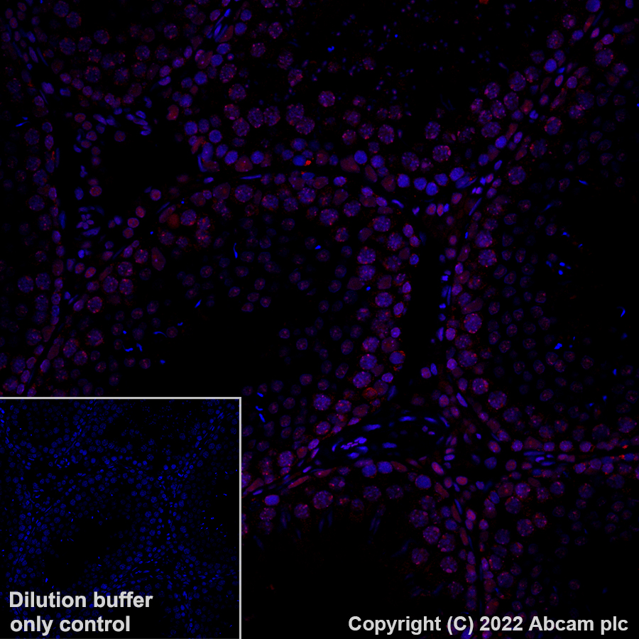 Immunohistochemistry (Formalin/PFA-fixed paraffin-embedded sections) - Alexa Fluor® 647 Anti-CBX1 / HP1 beta antibody [EPR24242-78] (AB307381), expandable thumbnail
