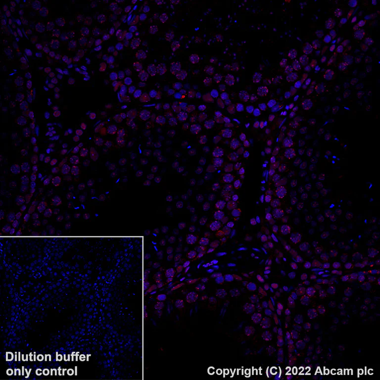 Immunohistochemistry (Formalin/PFA-fixed paraffin-embedded sections) - Alexa Fluor® 647 Anti-CBX1 / HP1 beta antibody [EPR24242-78] (AB307381)