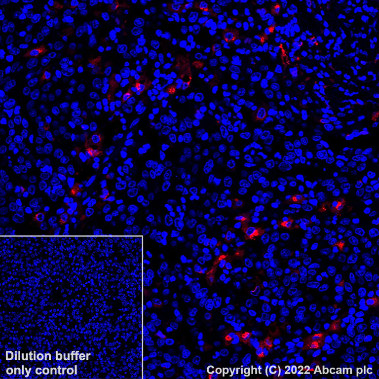 Immunohistochemistry (Formalin/PFA-fixed paraffin-embedded sections) - Alexa Fluor® 647 Anti-CCL18 antibody [EPR24781-84] (AB307404)