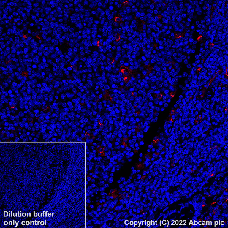 Immunohistochemistry (Formalin/PFA-fixed paraffin-embedded sections) - Alexa Fluor® 647 Anti-CCL18 antibody [EPR24781-84] (AB307404)