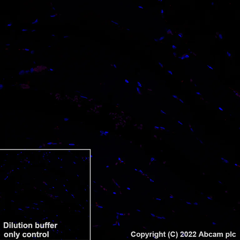 Immunohistochemistry (Formalin/PFA-fixed paraffin-embedded sections) - Alexa Fluor® 647 Anti-CCL18 antibody [EPR24781-84] (AB307404)