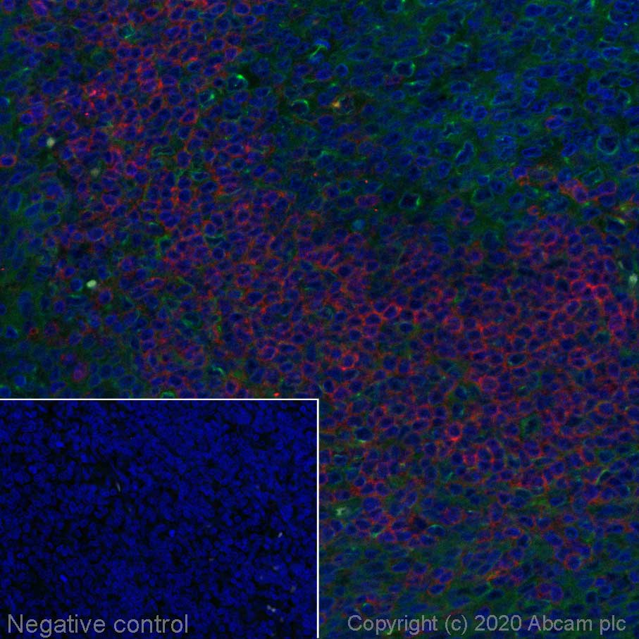 Immunohistochemistry (Formalin/PFA-fixed paraffin-embedded sections) - Alexa Fluor® 647 Anti-CCR7 antibody [EPR23192-57] (AB275165), expandable thumbnail