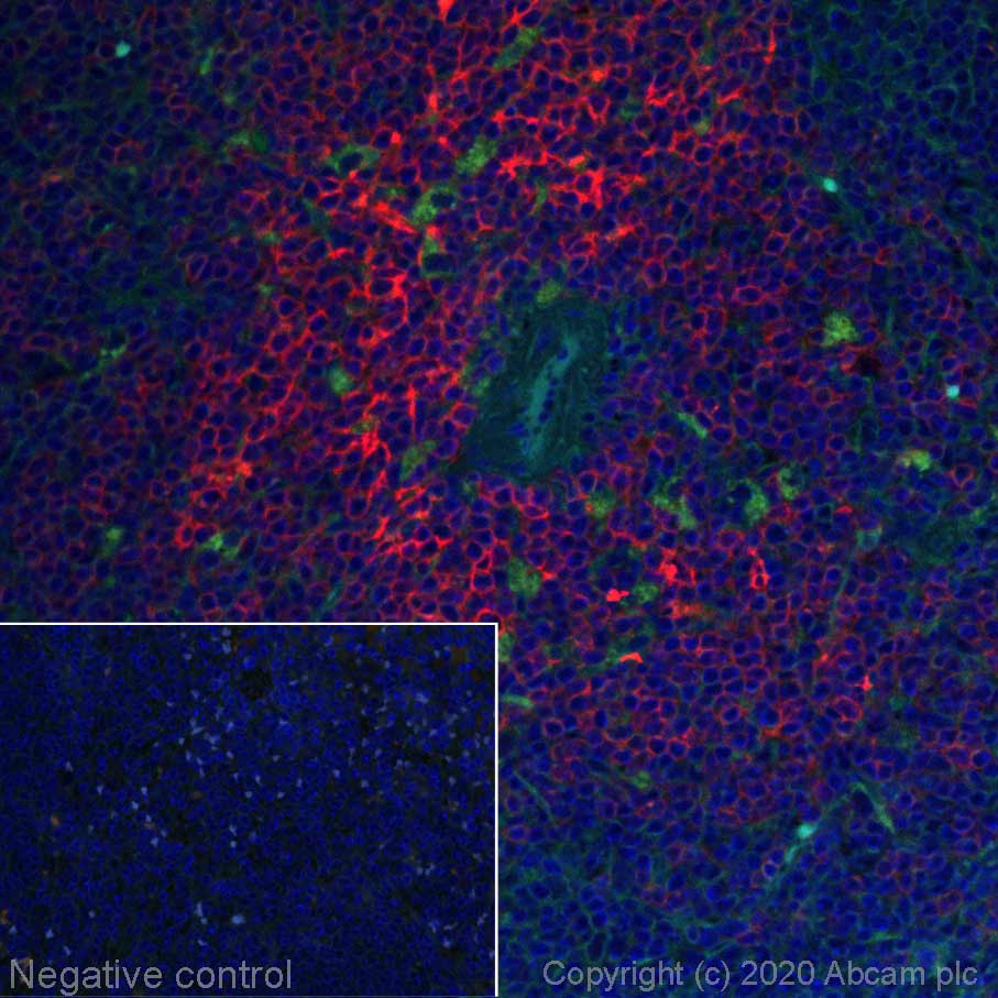 Immunohistochemistry (Formalin/PFA-fixed paraffin-embedded sections) - Alexa Fluor® 647 Anti-CCR7 antibody [EPR23192-57] (AB275165), expandable thumbnail