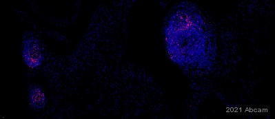 Immunohistochemistry (Formalin/PFA-fixed paraffin-embedded sections) - Alexa Fluor® 647 Anti-CCR7 antibody [EPR23192-57] (AB275165), expandable thumbnail