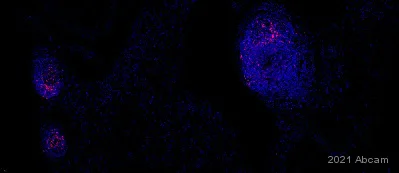 Immunohistochemistry (Formalin/PFA-fixed paraffin-embedded sections) - Alexa Fluor® 647 Anti-CCR7 antibody [EPR23192-57] (AB275165)