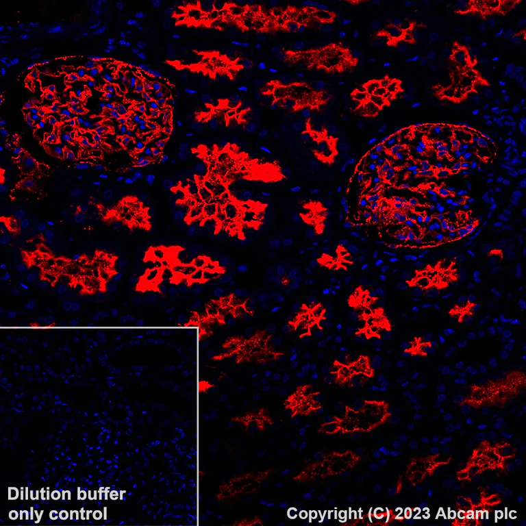 Immunohistochemistry (Formalin/PFA-fixed paraffin-embedded sections) - Alexa Fluor® 647 Anti-CD10 antibody [EPR22867-118] (AB309082)