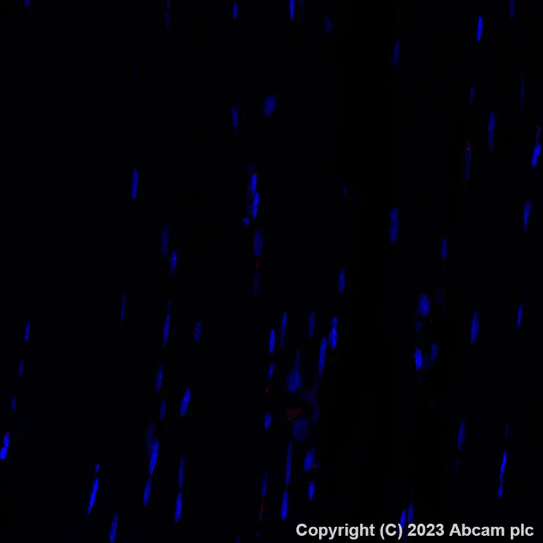 Immunohistochemistry (Formalin/PFA-fixed paraffin-embedded sections) - Alexa Fluor® 647 Anti-CD10 antibody [EPR22867-118] (AB309082)