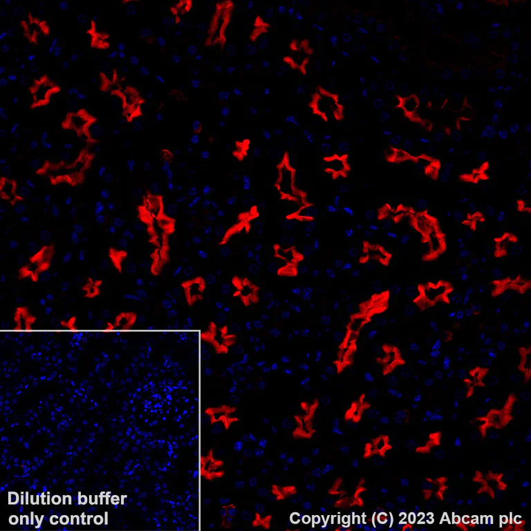 Immunohistochemistry (Formalin/PFA-fixed paraffin-embedded sections) - Alexa Fluor® 647 Anti-CD10 antibody [EPR22867-118] (AB309082)