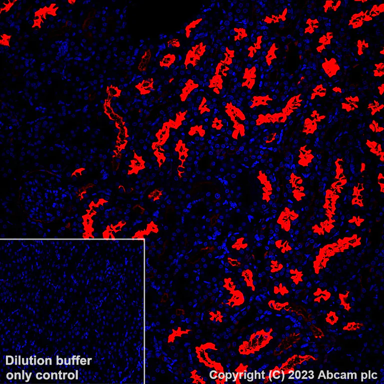Immunohistochemistry (Formalin/PFA-fixed paraffin-embedded sections) - Alexa Fluor® 647 Anti-CD10 antibody [EPR22867-118] (AB309082)