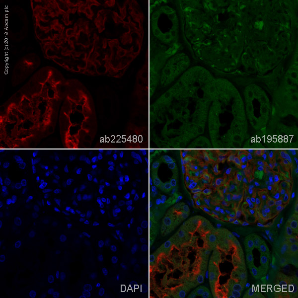 Immunohistochemistry (Formalin/PFA-fixed paraffin-embedded sections) - Alexa Fluor® 647 Anti-CD10 antibody [EPR5904-110] (AB225480), expandable thumbnail