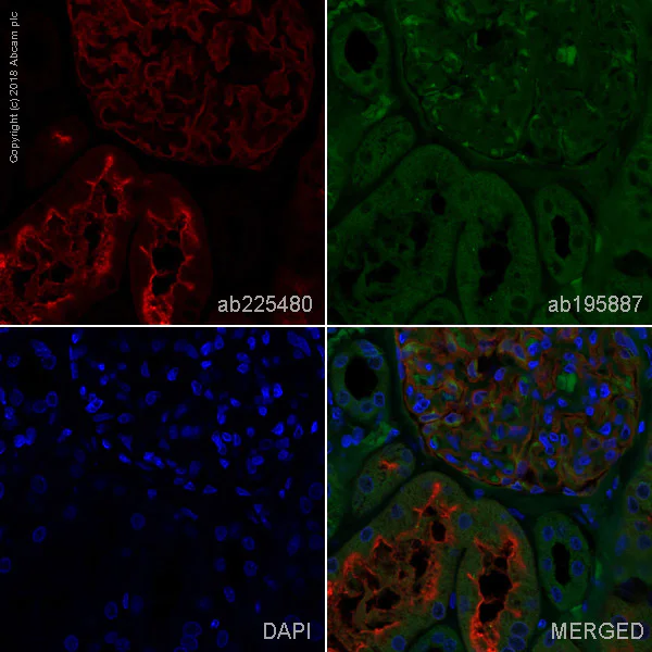 Immunohistochemistry (Formalin/PFA-fixed paraffin-embedded sections) - Alexa Fluor® 647 Anti-CD10 antibody [EPR5904-110] (AB225480)