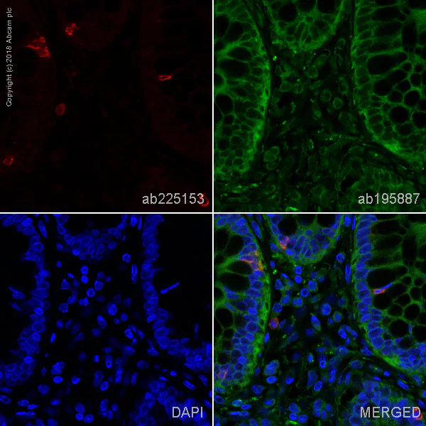Immunohistochemistry (Formalin/PFA-fixed paraffin-embedded sections) - Alexa Fluor® 647 Anti-CD103 antibody [EPR4166(2)] (AB225153)