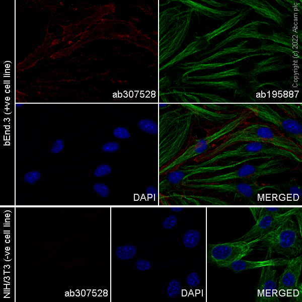 Immunocytochemistry/ Immunofluorescence - Alexa Fluor® 647 Anti-CD105 antibody [EPR21846] (AB307528)