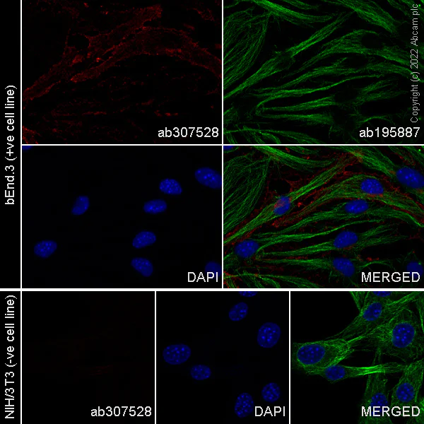 Immunocytochemistry/ Immunofluorescence - Alexa Fluor® 647 Anti-CD105 antibody [EPR21846] (AB307528)