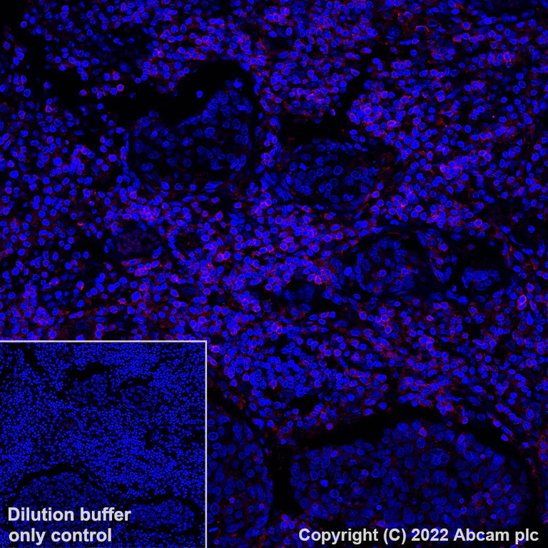 Immunohistochemistry (Formalin/PFA-fixed paraffin-embedded sections) - Alexa Fluor® 647 Anti-CD11a antibody [EP1285Y] (AB307264)