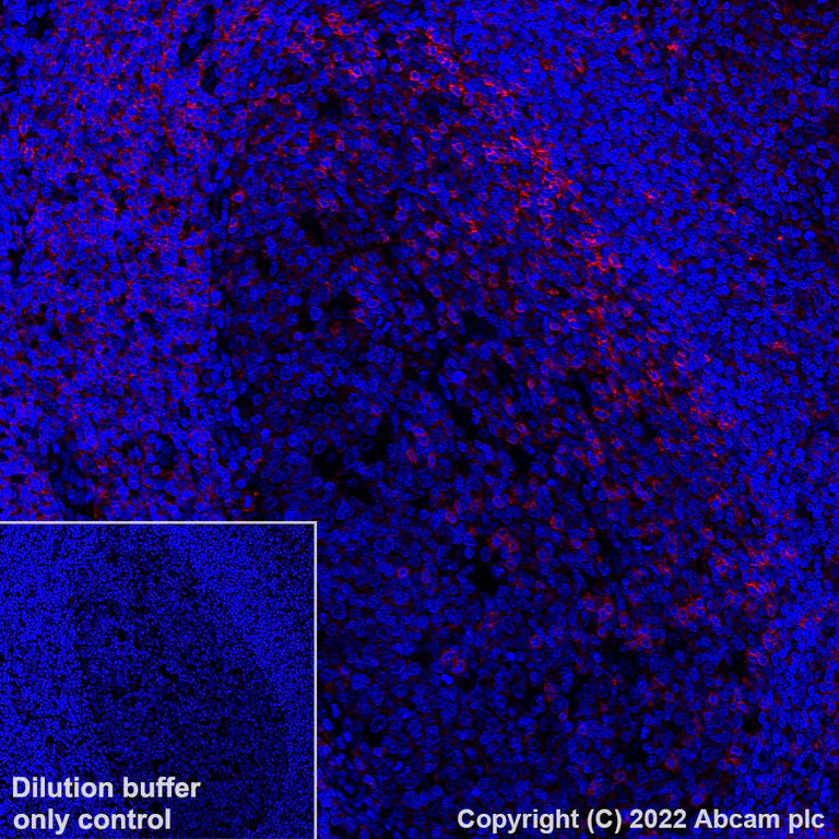 Immunohistochemistry (Formalin/PFA-fixed paraffin-embedded sections) - Alexa Fluor® 647 Anti-CD11a antibody [EP1285Y] (AB307264)