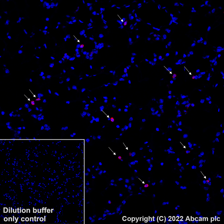 Immunohistochemistry - Alexa Fluor® 647 Anti-CD11b antibody [EPR1344] (AB307523), expandable thumbnail