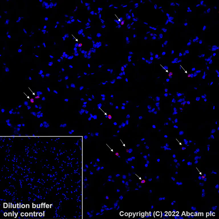 Immunohistochemistry - Alexa Fluor® 647 Anti-CD11b antibody [EPR1344] (AB307523)