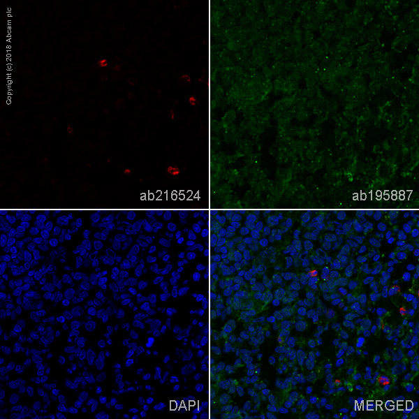 Immunohistochemistry (Frozen sections) - Alexa Fluor® 647 Anti-CD11b + CD11c antibody [OX42] (AB216524), expandable thumbnail