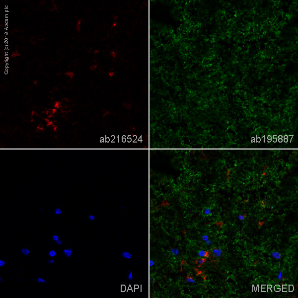 Immunohistochemistry (Frozen sections) - Alexa Fluor® 647 Anti-CD11b + CD11c antibody [OX42] (AB216524), expandable thumbnail