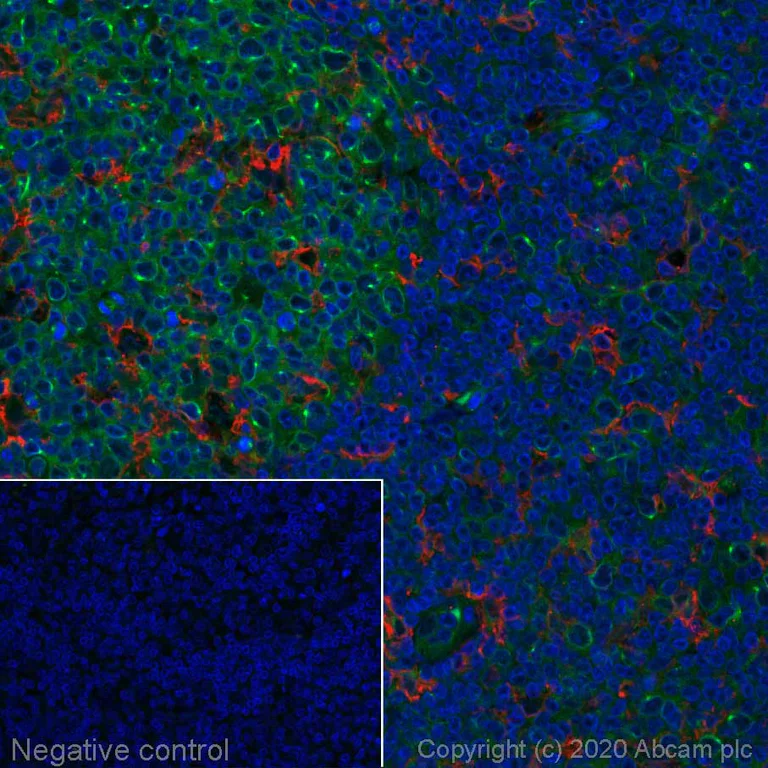 Immunohistochemistry (Formalin/PFA-fixed paraffin-embedded sections) - Alexa Fluor® 647 Anti-CD11c antibody [EP1347Y] (AB275338)
