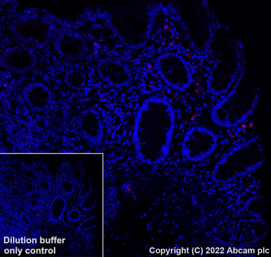 Immunohistochemistry (Formalin/PFA-fixed paraffin-embedded sections) - Alexa Fluor® 647 Anti-CD127 antibody [EPR23747-333] (AB303455)
