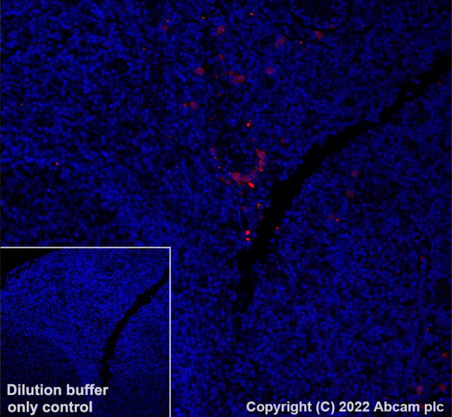 Immunohistochemistry (Formalin/PFA-fixed paraffin-embedded sections) - Alexa Fluor® 647 Anti-CD127 antibody [EPR23747-333] (AB303455)