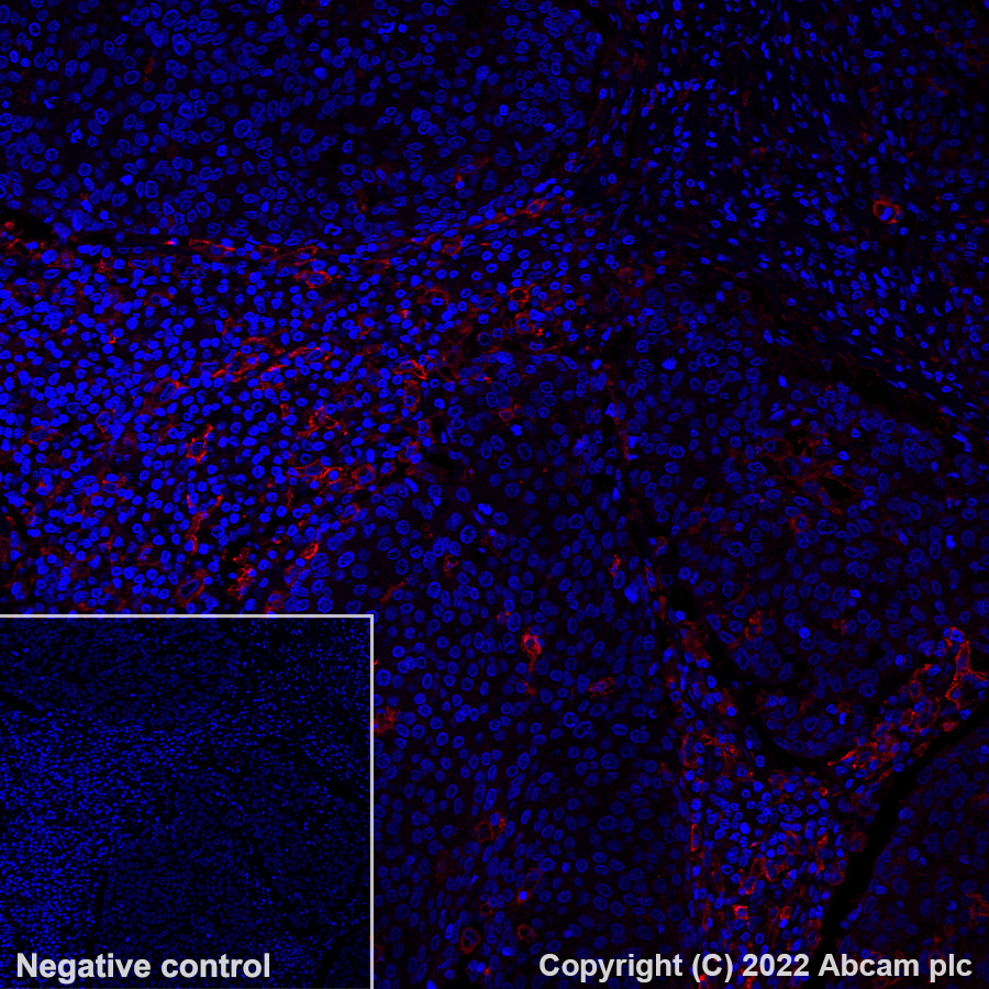 Immunohistochemistry (Formalin/PFA-fixed paraffin-embedded sections) - Alexa Fluor® 647 Anti-CD14 antibody [SP192] (AB302698), expandable thumbnail