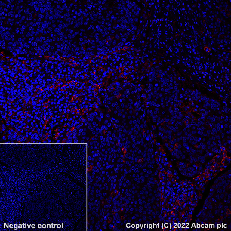 Immunohistochemistry (Formalin/PFA-fixed paraffin-embedded sections) - Alexa Fluor® 647 Anti-CD14 antibody [SP192] (AB302698)