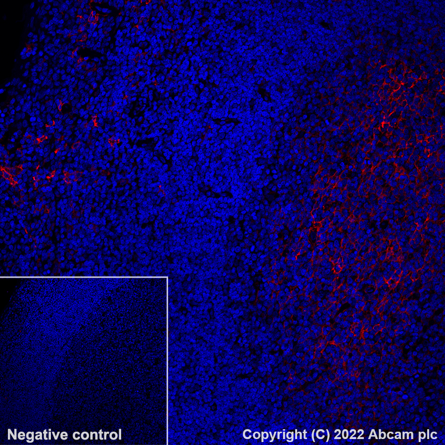 Immunohistochemistry - Alexa Fluor® 647 Anti-CD14 antibody [SP192] (AB302698), expandable thumbnail
