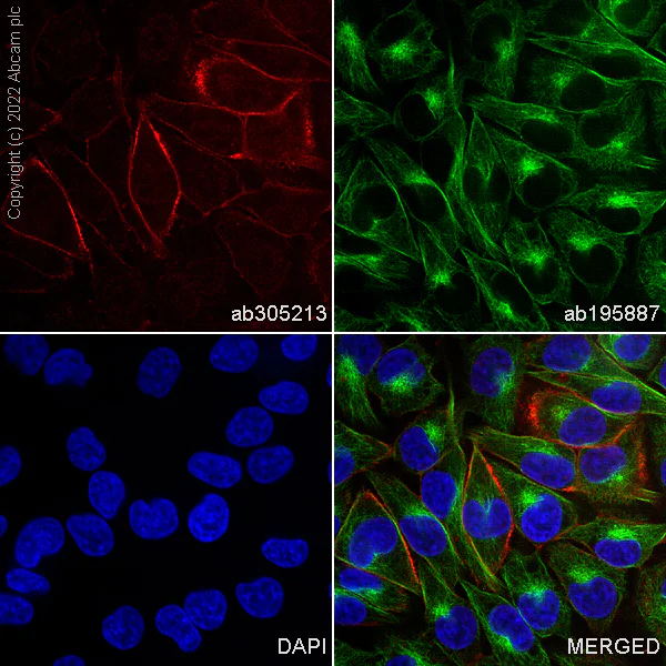 Immunocytochemistry/ Immunofluorescence - Alexa Fluor® 647 Anti-CD146 antibody [EPR3208] (AB305213)